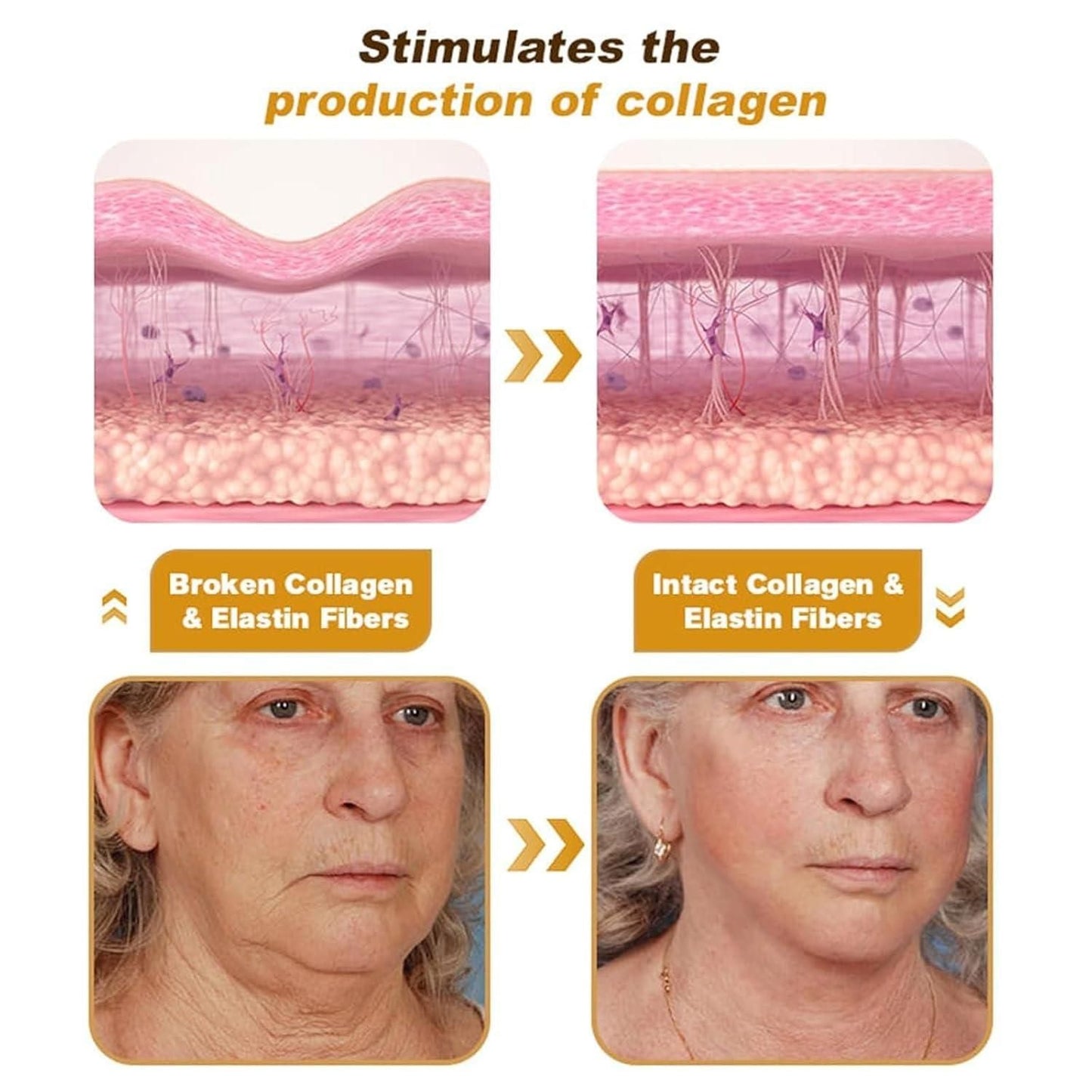 Bee Venom Wrinkle Repair Cream šāØ