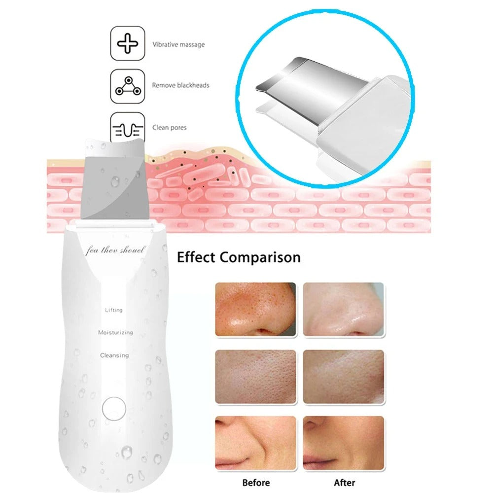 Ultrasonic Skin Scrubber Blackhead Remover